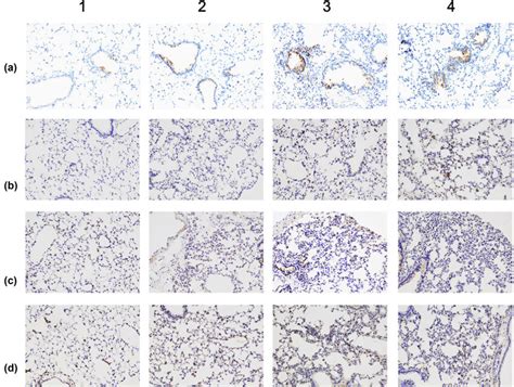 Illustrations Of Lung Inflammation Cytokine Immunostaining Columns