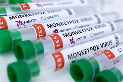 First Case Of New Mpox Variant In Germany