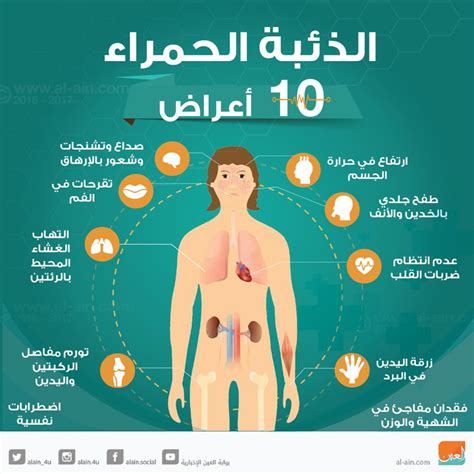 إنفوجراف الذئبة الحمراء مرض مزمن له أعراض