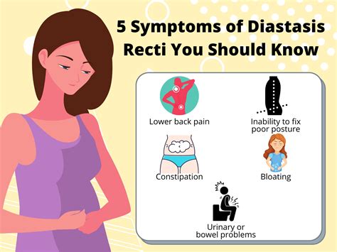 5 Symptoms of Diastasis Recti You Should Know - Industrial Blog