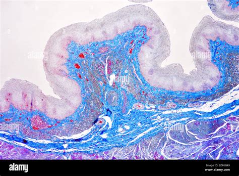 Human Esophagus Or Oesophagus Showing Squamous Epithelium Stratified