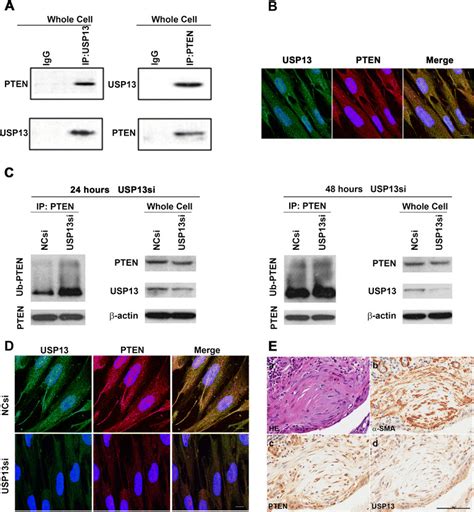 Levels Of Pten Ubiquitination And Degradation In Usp Deficient Lung