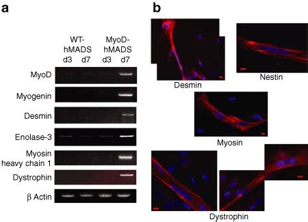 Muscle Differentiation Markers Expressed In Myod Hmads Cells A