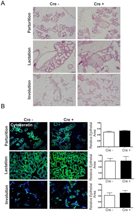 Mammary Glands Of Cx26 Knockdown Mice Have Similar Epithelial