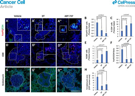 Figure From Clearance Of Senescent Macrophages Ameliorates