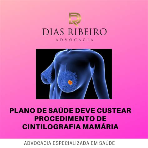 Plano de saúde deve custear procedimento de cintilografia mamária