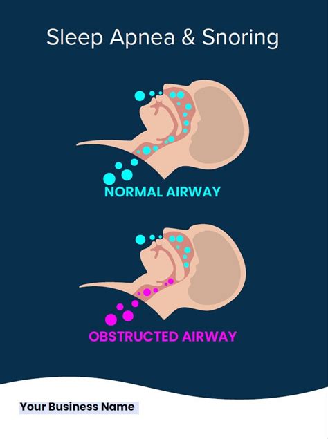 Fillable Sleep Apnea Airway Poster 18x24 Size Etsy