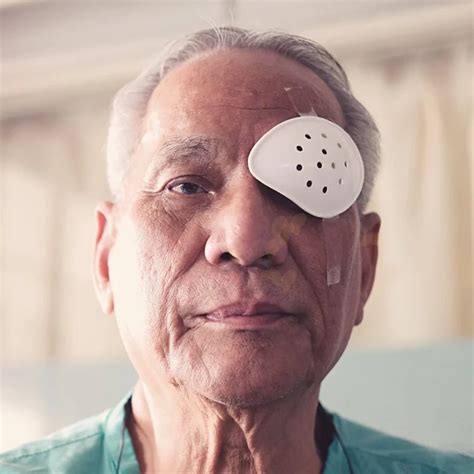 Floaters After Cataract Surgery Causes Treatment EyeFACTS