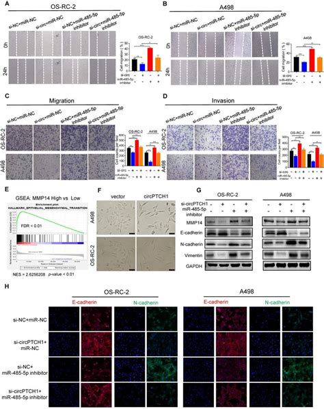 Circptch Facilitates Migration Invasion And Emt Of Rcc Cells Through