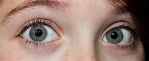 6 Rare and Unique Eye Colors | Grey green eyes, Rare eye colors, Blue ...