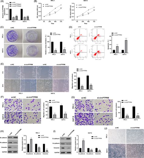 Circptprm Knockdown Restrains Malignant Phenotypes Of Ptc Cells A