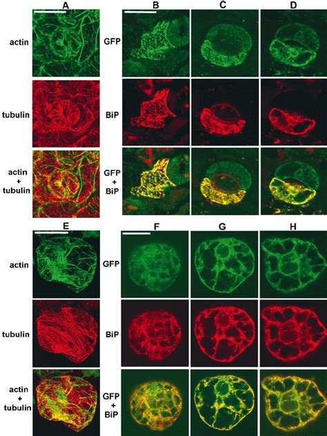 Membrane Bound KKRYGFP Colocalizes With The ER Marker Protein BiP In