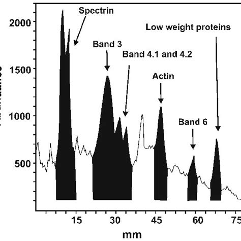 Densitogram of control sample with marked protein fractions. | Download ... 