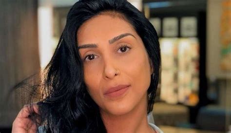 Lipedema Ex BBB Amanda Djehdian recebe diagnóstico de doença sem cura