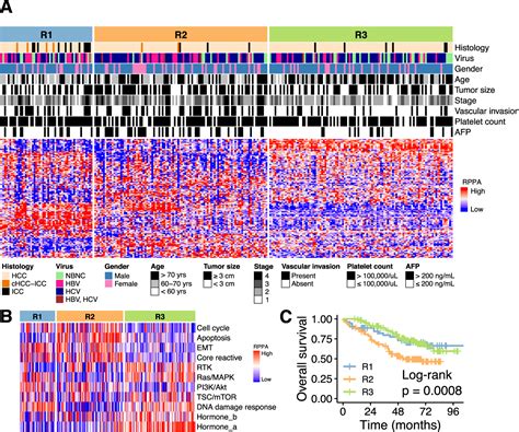 Large Scale Proteo Genomic Profiling Of Virus Associated Liver Cancer