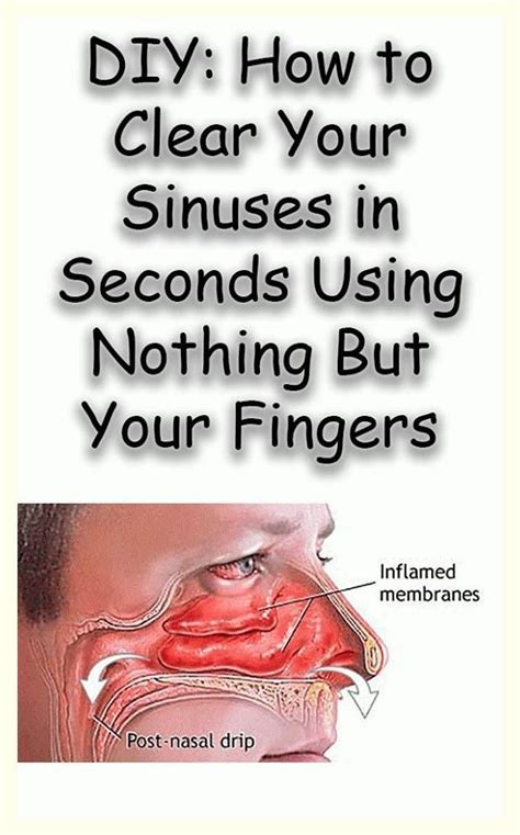 How To Clear Your Sinuses In Seconds Using Nothing But Your Fingers