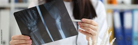 Doctor traumatologist examines x-ray with arm injury closeup Stock Photo | Adobe Stock