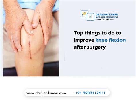 Top Things To Do To Improve Knee Flexion After Surgery Dr Anjani