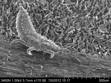 Scanning Electron Microscope Blog: An unexpected bonus - a thrip larva