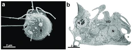 G Intestinalis After Beta Lapachone Treatment A Scanning Electron Download Scientific