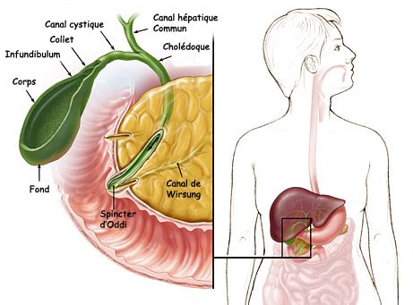 Calcul vésiculaire lithiase biliaire Rôle de la vésicule