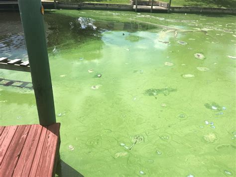 Bacteria In Pond Water