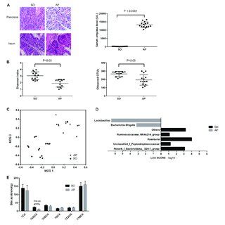 | Gut microbiota and bile acid metabolism changes in AP mice. (A ...