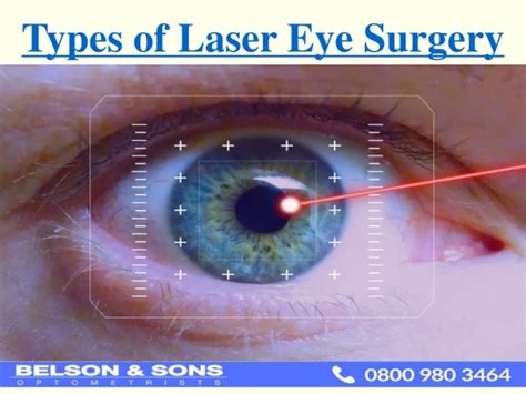 PPT - Laser Eye Surgery PowerPoint Presentation, free download - ID:1272032