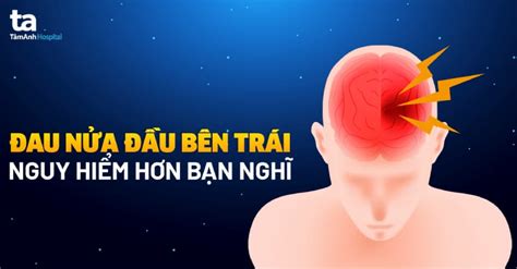 Đau nửa đầu bên trái Nguyên nhân triệu chứng và cách phòng ngừa