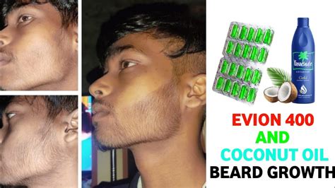 Evion 400 For Beard Growth Evion 400 And Coconut Oil For Beard Growth