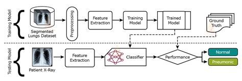 Deep Learning Pneumonia Detection Project Using Chest X Ray Images