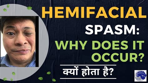 Hemifacial Spasm Why Does It Happen Dr Jaydev Panchwagh Youtube