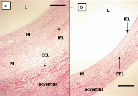 Representative Photomicro Graphs Month After Implantation Of Control