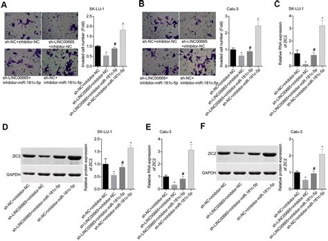 Downregulation Of Linc Suppresses The Progression Of Lung