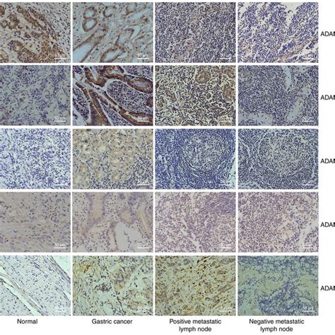 Immunohistochemical Analysis Showing The Expression Of Adam Adam