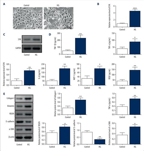 Figure From Spleen Tyrosine Kinase Syk In The Progression Of