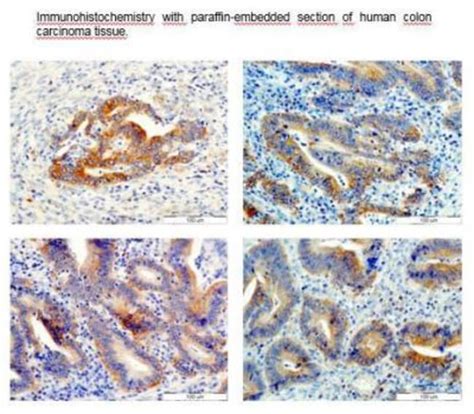 VEGF C Antibody 9E7 Azide And BSA Free Novus Biologicals 0 02 Mg