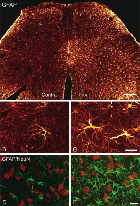 Confocal Images Showing The Increase In The Astrocyte Marker Gfap In