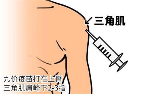 九价注射在哪个部位39健康网精编内容