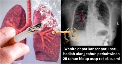 Hadiah Ulang Tahun Perkahwinan Wanita Derita Hidap Kanser Paru Paru