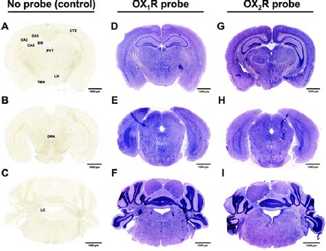 Representative Sections Hybridized With Orexin Receptor Rna Probes