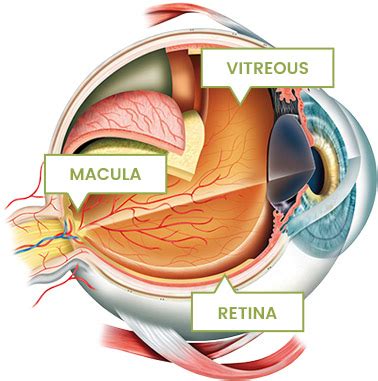 Rocky Mountain Retina Consultants