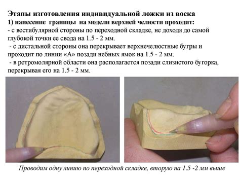 Изготовление индивидуальной ложки - презентация онлайн