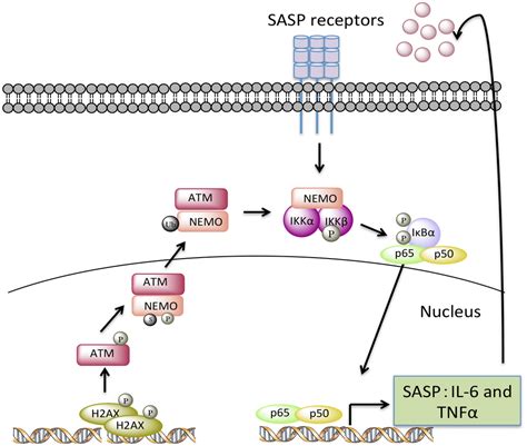 ATM is a key driver of NF κB dependent DNA damage induced senescence