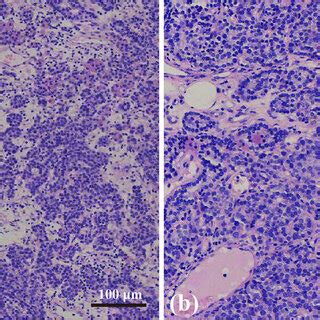 The Hematoxylin And Eosin H E Stained Tissue Sections Revealed The