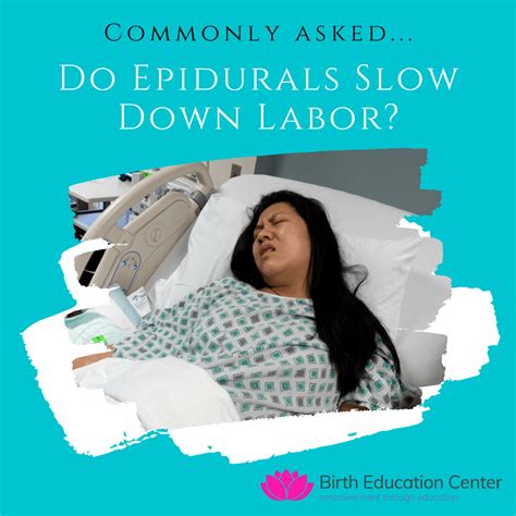 Do Epidurals Slow Down Labor Birth Education Center