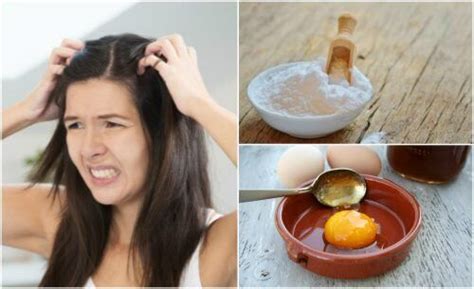 Home Remedies For Severe Dandruff Treatment