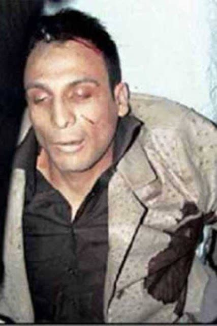 Valentin Elizalde Autopsy