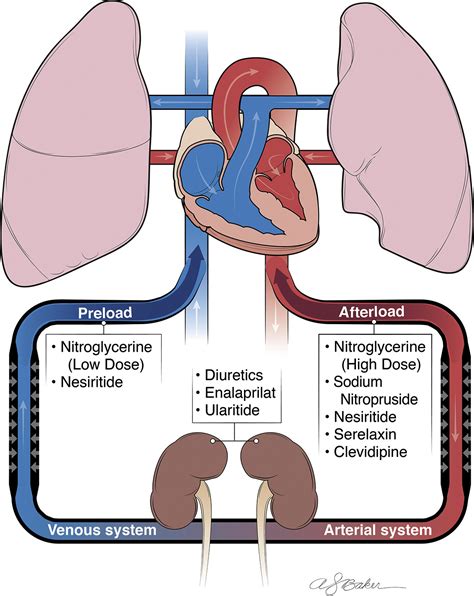 Management Of Acute Hypertensive Heart Failure Heart Failure Clinics