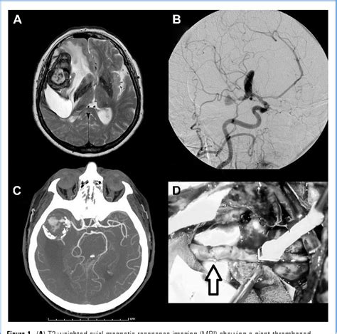 Figure From Intraoperative Functional And Perfusion Monitoring During